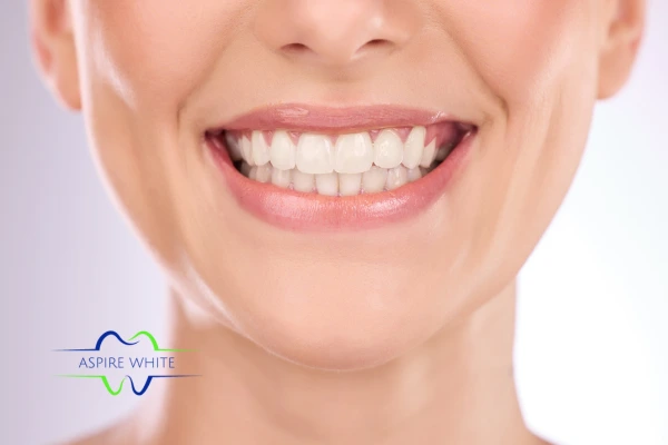 Follow your teeth whitening aftercare Portsmouth to prolong your whiter smile!