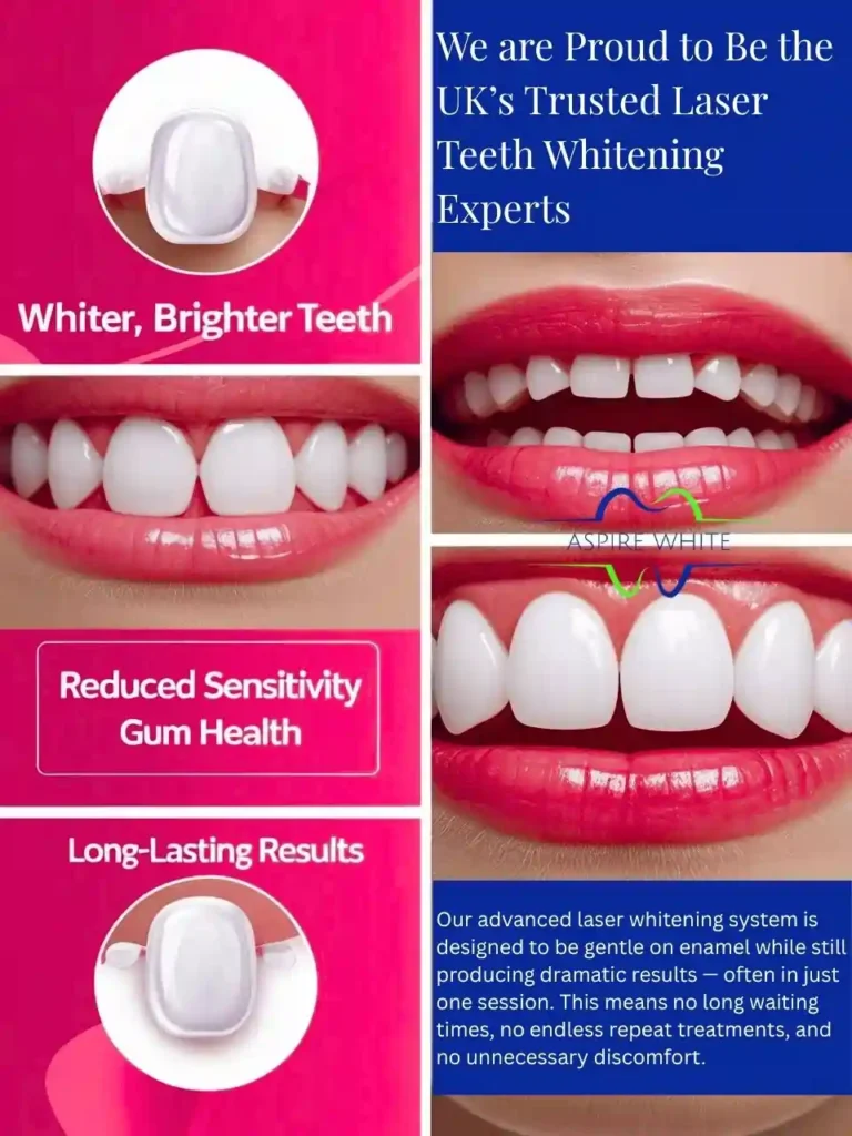 We are Proud to Be the UK’s Trusted Laser Teeth Whitening Experts Portsmouth